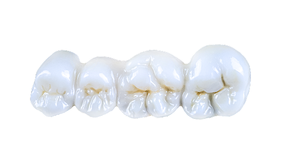 zirconia-crown-img